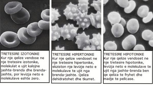 Në pamjen më lartë, me mikroskopi elektronike me skansion, paraqiten rruaza të kuqe gjaku në tretësia të ndryshme: izotonike, hipertonike dhe hipotonike. 
